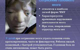Сотрясение мозга: ужасные факты